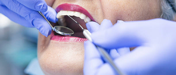 Best Urgent Care for Lost Fillings or Crowns in El Centro, CA